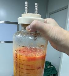 抚州水动力吸脂手术要做多久？